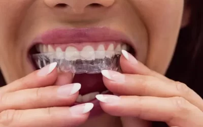 Invisalign Valley Village: Clear Aligner Therapy for Discreet Orthodontic Correction